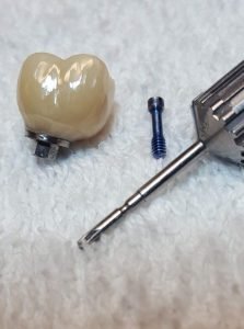 Implant_Crn__Ti_Base3_crop-e1568233478407